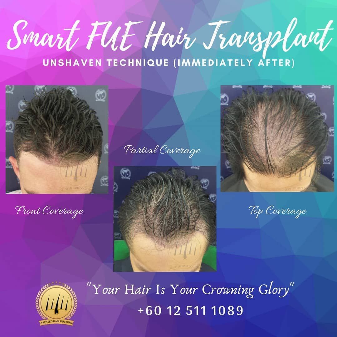 Rawatan Protein Rumah Untuk Rambut Lemah: 5 Kaedah Mudah Yang Boleh Dilakukan Di Rumah