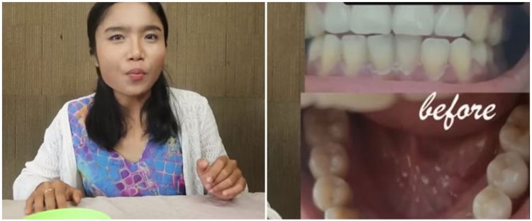 Deodoran DIY Tanpa Baking Soda: Cara Mudah Untuk Keseimbangan Kulit Dengan Alami