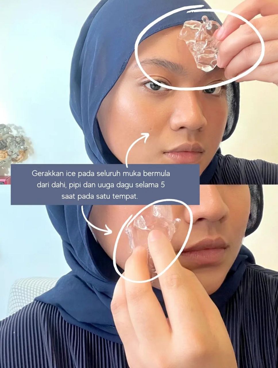 Menggunakan Kiub Ais Untuk Pori Terbuka: Cara Mencegah Dan Menguruskannya